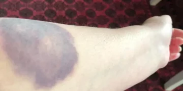 طالبان یک زن را در کابل به دلیل قدم‌زدن در پارک لت‌وکوب کرده‌اند