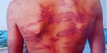 فقر و خشونت؛ سه کودک در هرات قربانی بدرفتاری مادر اندر شدند