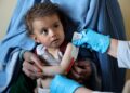 سازمان جهانی بهداشت: بیش از 56 هزار کودک دچا سوءتغذیه‌ شدید را درمان کردیم