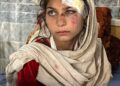 سازمان ملل: بحران اقتصادی و جنگ خشونت بر زنان را تشدید می‌‌کند